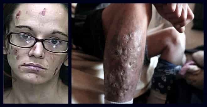 efectos del cristal en la piel